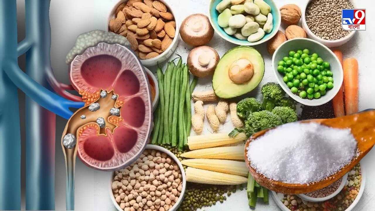 Kidney Stone: কিডনিতে পাথরের হাত থেকে রক্ষা পেতে চান? ভয় না পেয়ে মেনে চলুন এই সব সহজ নিয়ম