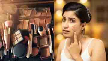 Acne-Makeup: আপনার মেকআপই ব্রণর জন্য দায়ী নয় তো? বুঝবেন যে উপায়ে...