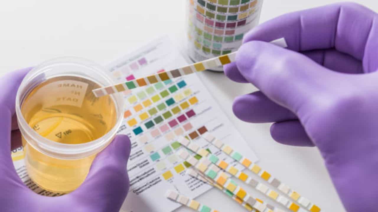 Urine: আপনার প্রস্রাবের রংই বলে দেবে আপনি কতটা সুস্থ Urine: আপনার প্রস্রাবের রংই বলে দেবে আপনি কতটা সুস্থ