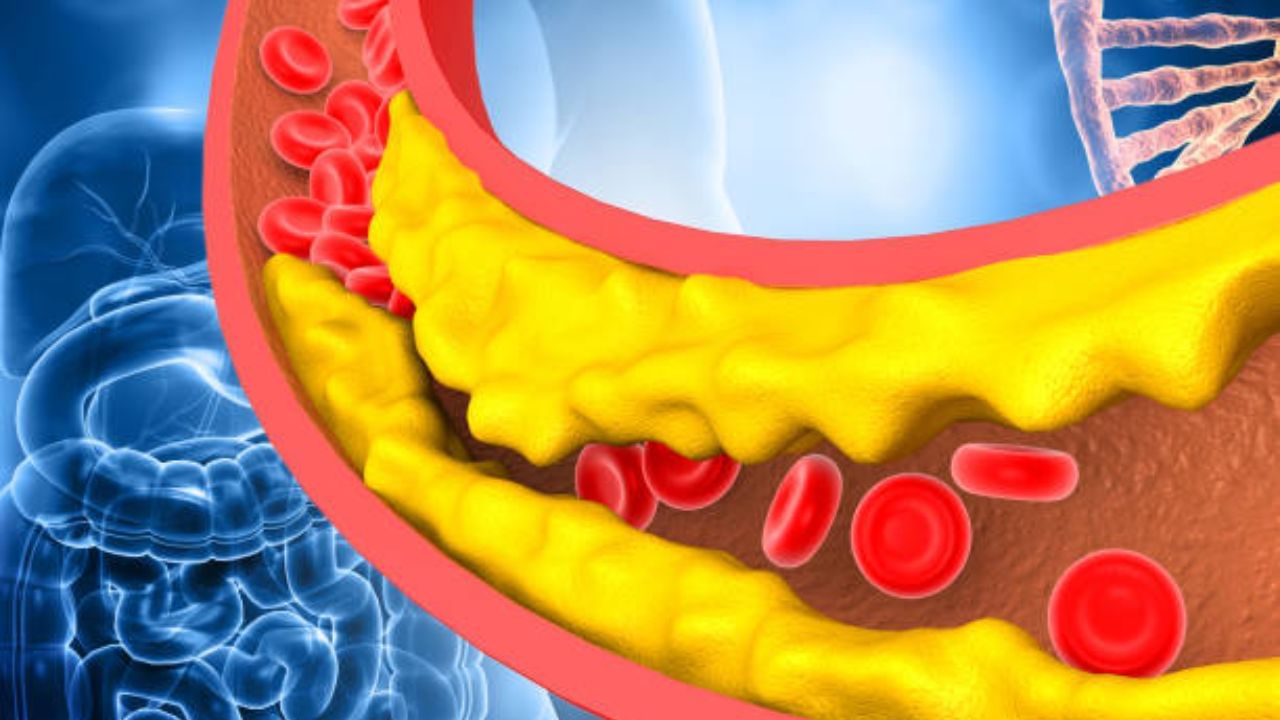 কোলেস্টেরল বাড়লে সেখান থেকে হাই ব্লাডপ্রেশারের সম্ভাবনা থেকে যায়। আর এর মূল কারণই হল ধমনীতে কোলেস্টেরল জমা হওয়া। এর ফলে রক্তনালী মোটা হয়ে যায়। 