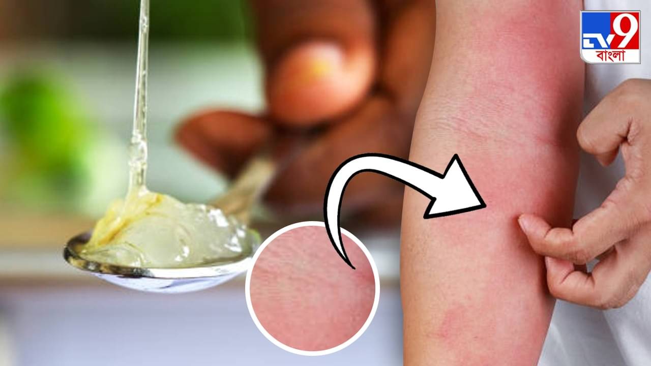 Aloe Vera Side Effects: জেনে-বুঝে অ্যালোভেরা জেল ব্যবহার করছেন তো? নইলে ঘাড়ে এসে পড়বে এই সব বিপদ