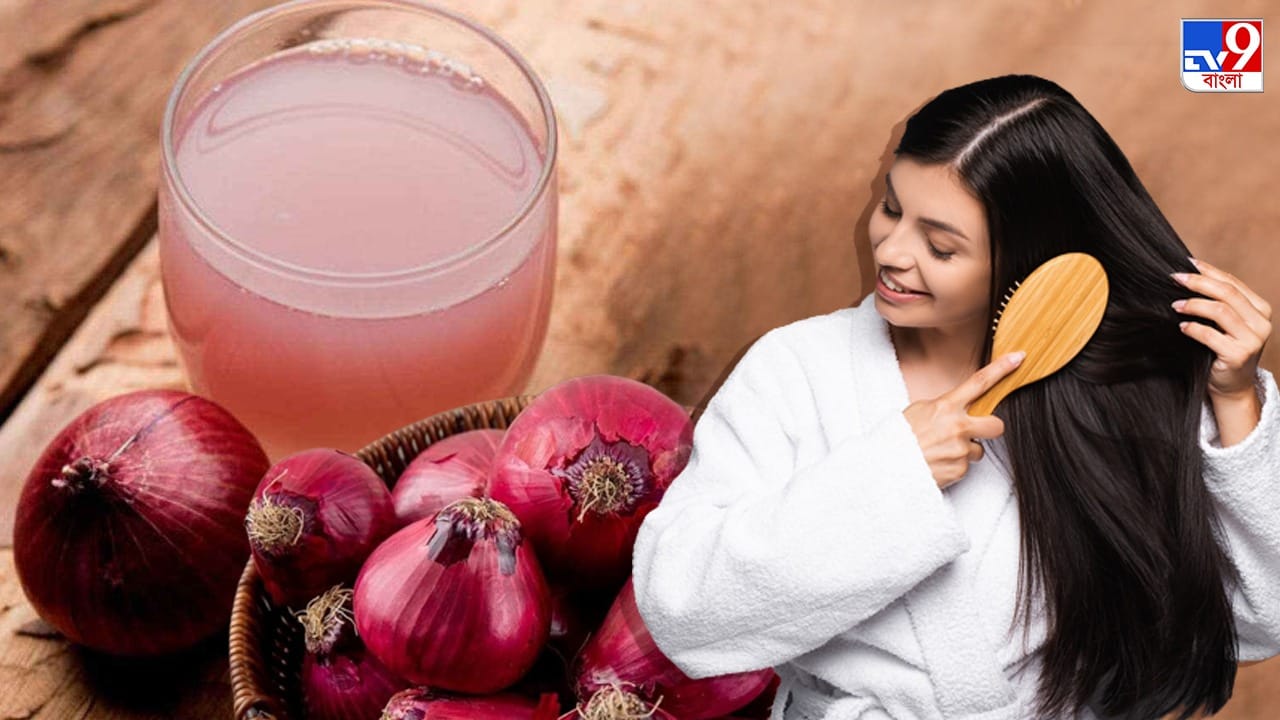 Onion For Hair Care চুল পড়া, খুশকির সমস্যাকে চিরতরে বিদায় জানান