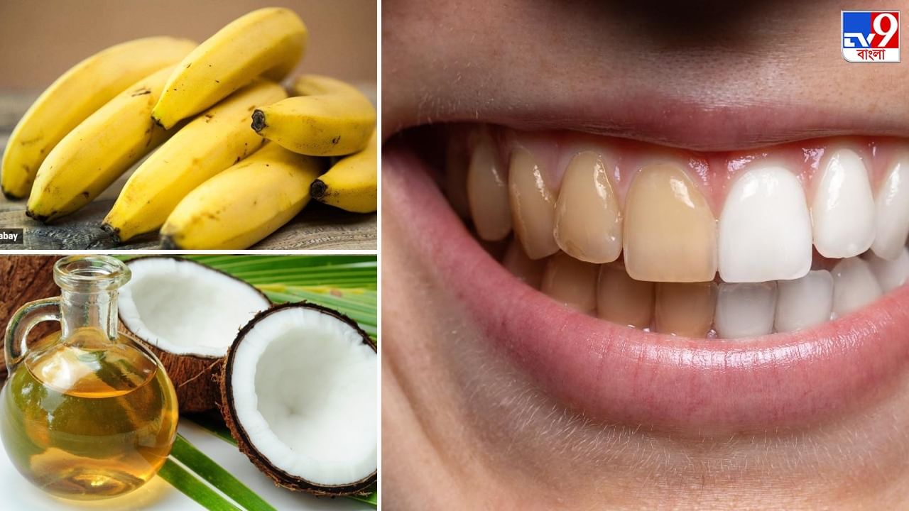 Yellow Teeth Care দাঁতে হলুদ ছোপ? চিন্তা নেই, ঘরোয়া উপায়ে পান
