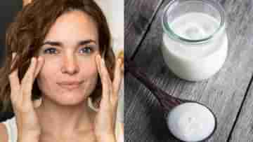 Yogurt-Anti Aging: বয়স বাড়তেই মুখে স্পষ্ট বলিরেখা, টক দই মাখলে কি কোনও উপকার মিলবে?