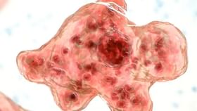 Brain-Eating Amoeba: ২ বছরের শিশুর মস্তিষ্ক খেয়ে নিল অ্যামিবা! Brain-Eating Amoeba: ২ বছরের শিশুর মস্তিষ্ক খেয়ে নিল অ্যামিবা!