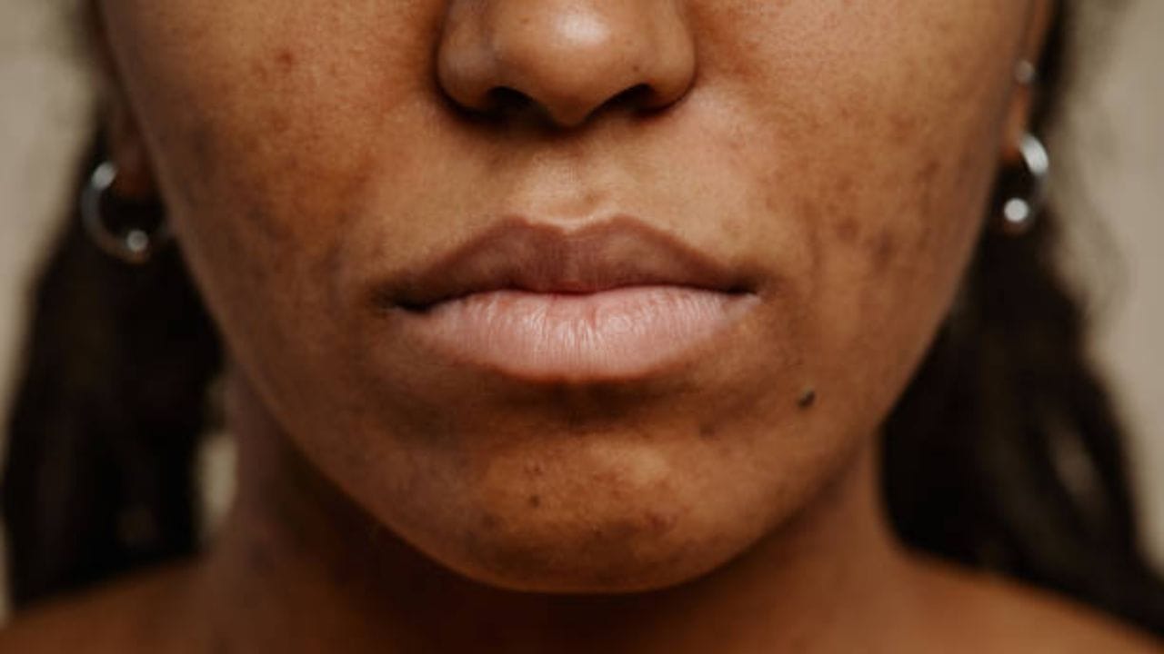 সব সময় এরকমও নয় যে ফেসওয়াশ দিয়ে মুখ ধুলেই মুখ পরিষ্কার হয়ে যাবে। ত্বকের ভেতর থেকে ময়লা তুলে ফেলতে ডিপ ক্লিনজিং প্রয়োজন। 