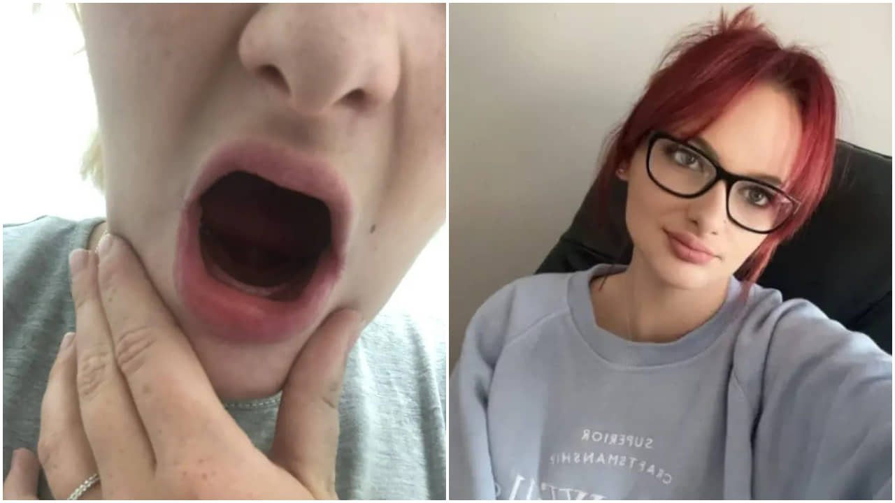 United Kingdom: গর্ভাবস্থায় সবকটি দাঁত পড়ে গেল মহিলার, এমনটা কিন্তু হতে পারে সবারই