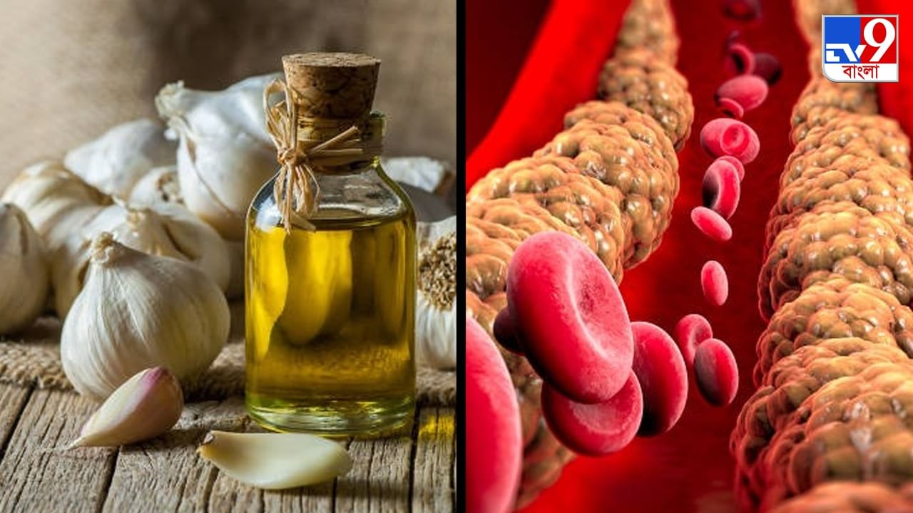 Cholesterol Remedy সপ্তাহে একবার এইভাবে রসুন খেলে সব কোলেস্টেরল গলে