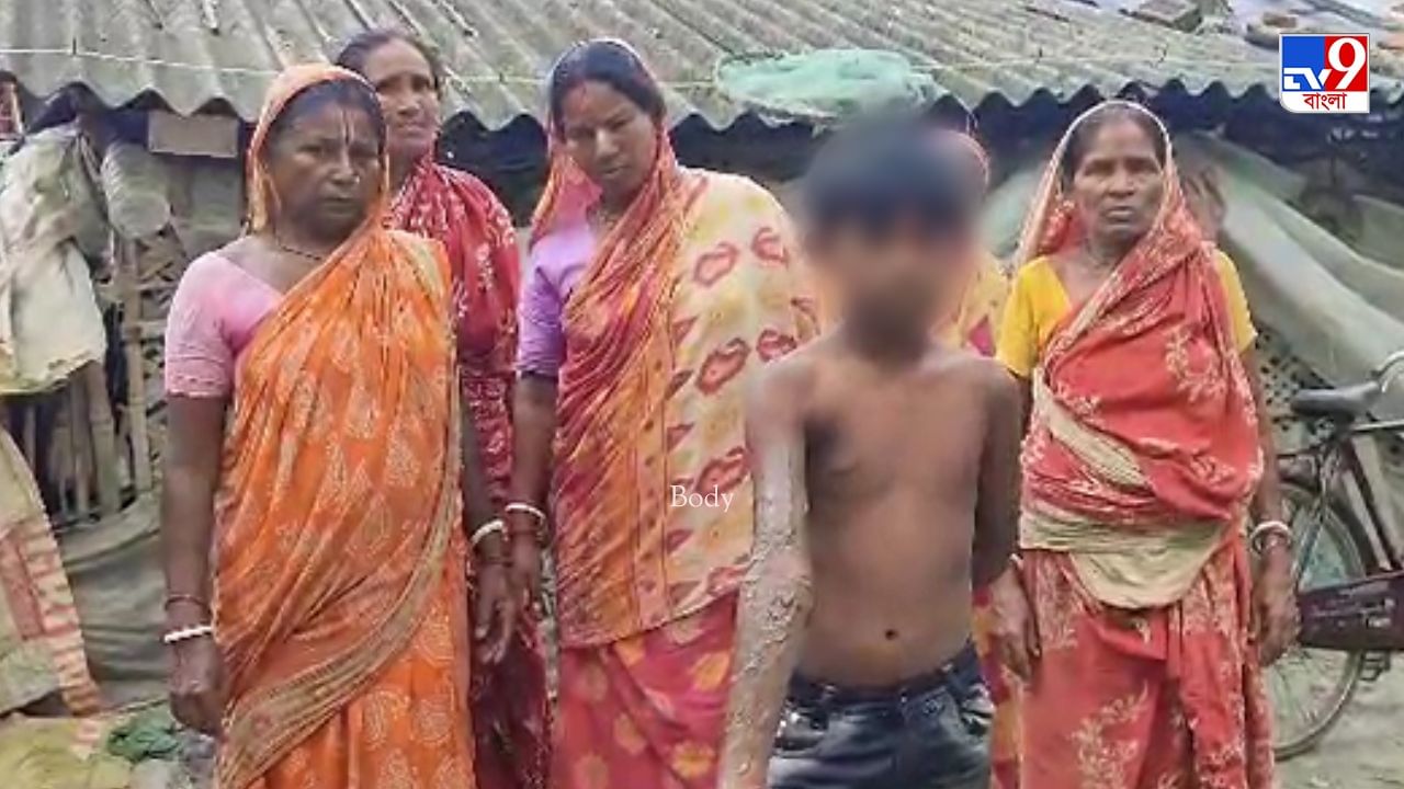 School Student: বোতলের তরল চলকে পড়তেই কাটা পাঁঠার মতো ছটফটানি শিশুদের School Student: বোতলের তরল চলকে পড়তেই কাটা পাঁঠার মতো ছটফটানি শিশুদের