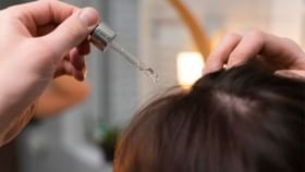 Hair Problem Solution: টাকে ফিরবে চুল? Hair Problem Solution: টাকে ফিরবে চুল?