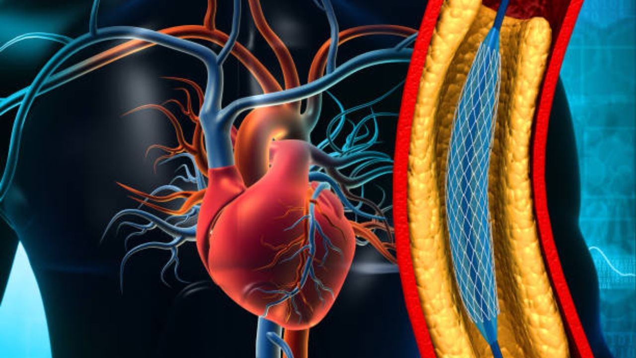 High Cholesterol Symptoms শরীরের এই ৫ অংশে ব্যথার অর্থ হল চড়চড়িয়ে
