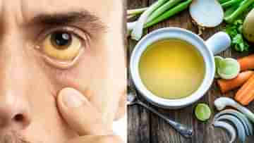 Jaundice Diet Tips: বেড রেস্টের পাশাপাশি কোন ধরনের খাবার খেলে কমবে বিলিরুবিনের মাত্রা?