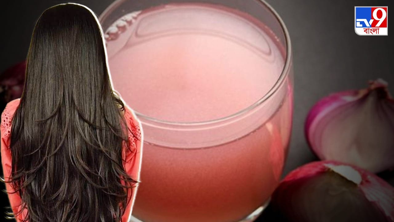 Onion For Hair চুল পড়া রোধ হবে ও নতুন চুল গজাবেই, শুধু এভাবে ব্যবহার