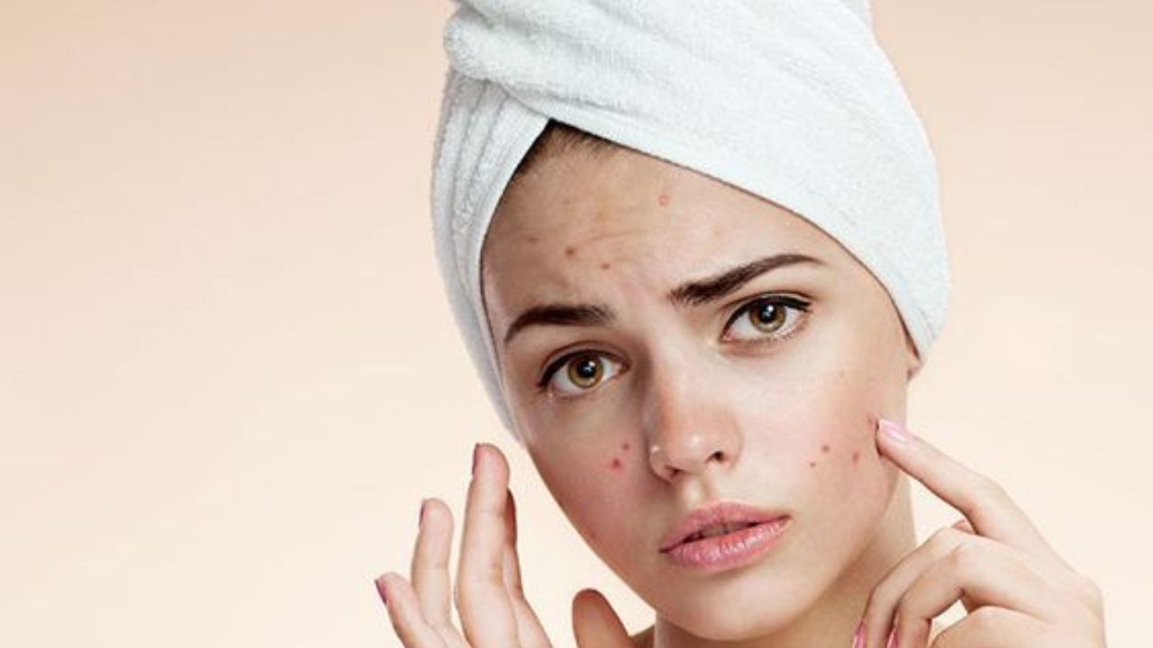 বর্ষা আসলেও কমেনি গরম। ভ্যাপসা গরমে ও বাতাসের আর্দ্রতায় তাই বেহাল দশা ত্বকের। এই সময় বেড়েছে ত্বকের নানা সমস্যা।