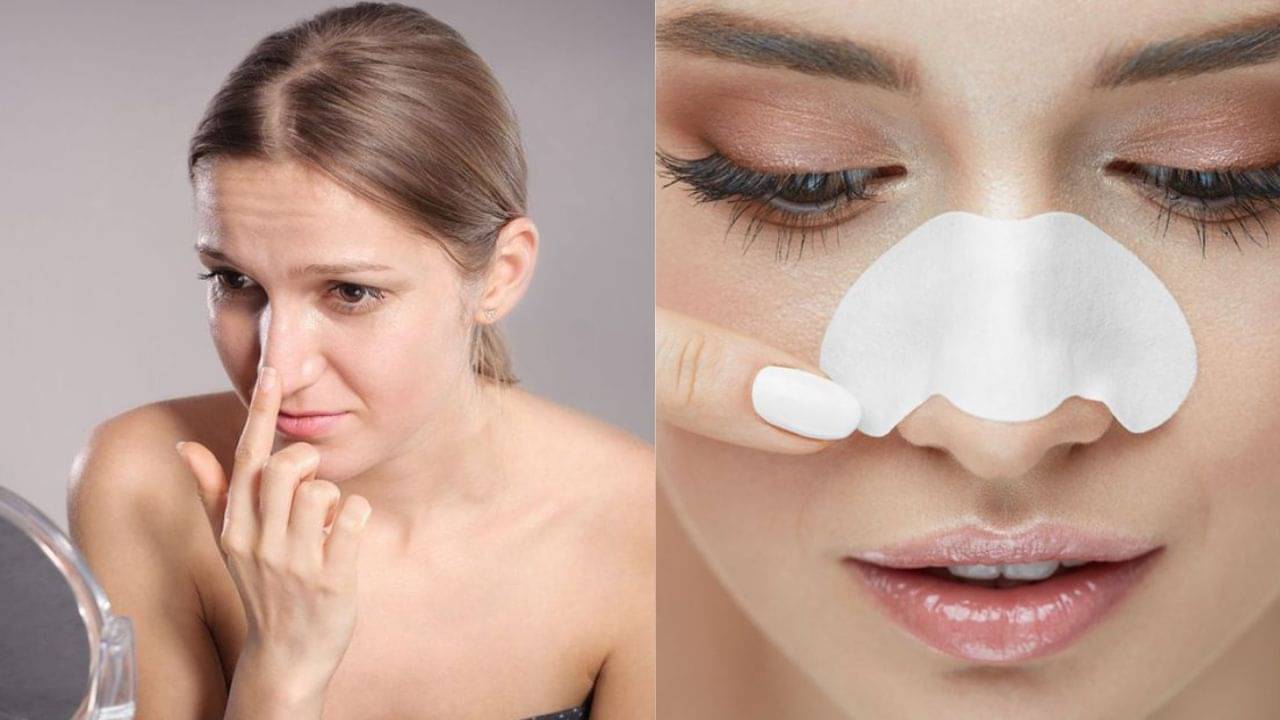 Blackheads Removal: ব্ল্যাকহেডসের সমস্যা থেকে দ্রুত মুক্তি পেতে এই ভুলগুলি কি আপনিও করেন? সতর্ক হন