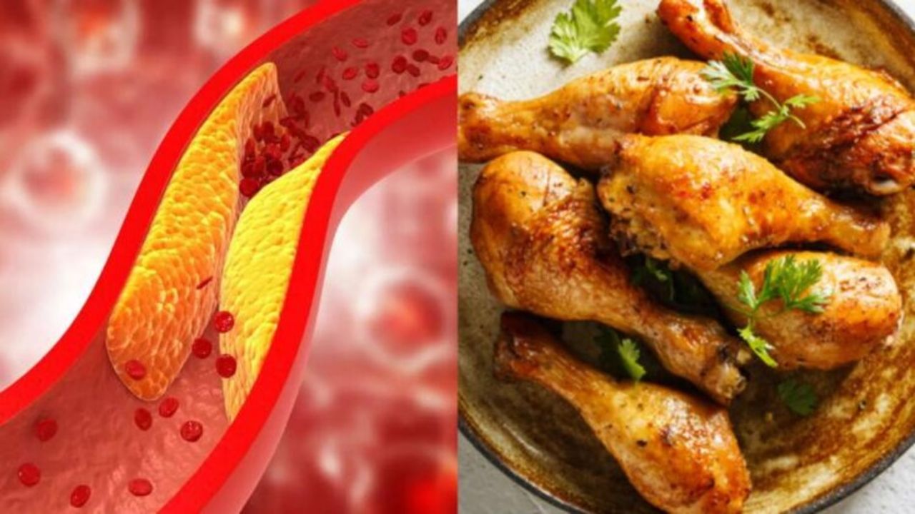 Cholesterol মাংস খেলেই বাড়বে কোলেস্টেরল, অবিলম্বে লাগাম টানুন ডায়েটে