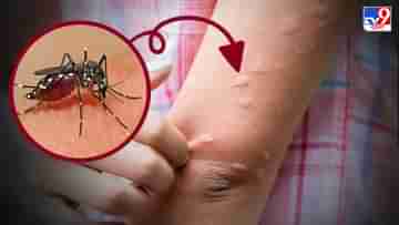 Japanese Encephalitis: আতঙ্ক বাড়াচ্ছে জাপানিজ এনসেফ্যালাইটিস, অসমে মৃত ১১