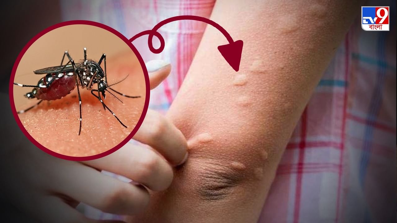 Japanese Encephalitis: আতঙ্ক বাড়াচ্ছে জাপানিজ এনসেফ্যালাইটিস, অসমে মৃত ১১