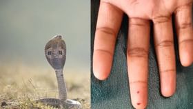 Kalaburagi snake: বাড়ি বদলেও পিছু ছাড়ছে না সাপ! ২ মাসে নয়বার কামড় খেল কিশোর Kalaburagi snake: বাড়ি বদলেও পিছু ছাড়ছে না সাপ! ২ মাসে নয়বার কামড় খেল কিশোর