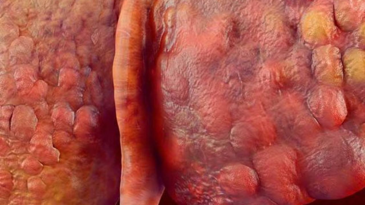 আপনি যদি  লিভারকে সুস্থ চান, তাহলে আপনার খাদ্যতালিকায় বাদাম এবং বীজ অন্তর্ভুক্ত করুন। বাদাম, শণের বীজ এবং আখরোটে ভিটামিন ই ও ওমেগা ৩ ফ্যাটি অ্যাসিড পাওয়া যায়।যা লিভারের কার্যকারিতা বাড়ায়।