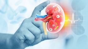 Food For Kidney Health: ৫ খাবারে বাঁচবে কিডনি Food For Kidney Health: ৫ খাবারে বাঁচবে কিডনি