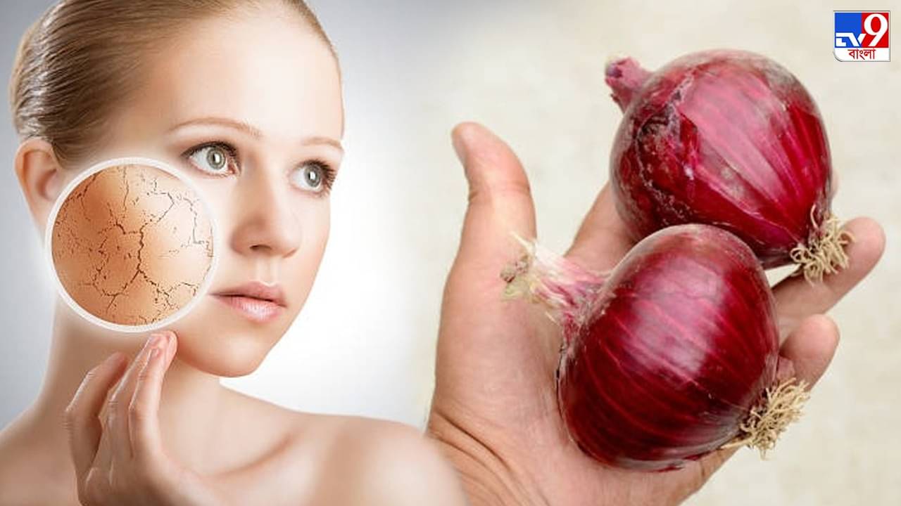 Anti Ageing Cream: ত্বক হবে ২০ বছরের মতো ফর্সা, টানটান যদি বাড়িতেই পেঁয়াজ দিয়ে বানিয়ে নেন এই ক্রিম