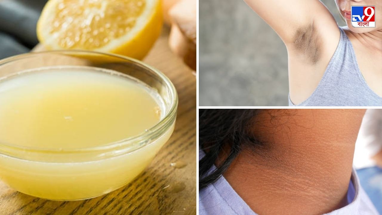 Dark underarms: গোপনাঙ্গের কালো নোংরা দাগ তুলে ফেলুন সহজ এই ঘরোয়া টোটকায়, ত্বক হবে কাচের মত ফর্সা Dark underarms: গোপনাঙ্গের কালো নোংরা দাগ তুলে ফেলুন সহজ এই ঘরোয়া টোটকায়, ত্বক হবে কাচের মত ফর্সা