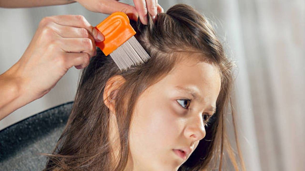 Remove Lice: বাড়ির খুদের মাথায় উকুন হয়েছে? এভাবে চুল আঁচড়ালে ১ সপ্তাহে দূর হবে সমস্যা