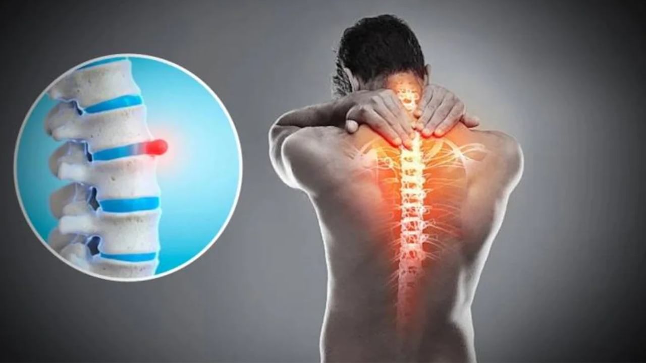 Bone Health Problem: পিঠের ব্যথায় ভুগছেন?