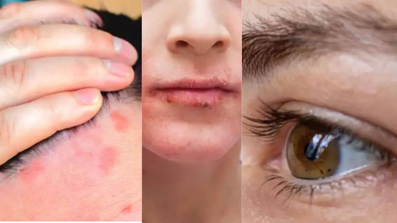 Cholesterol: কোলেস্টেরল বেড়েছে? জানান দেবে চোখ ও ত্বকের কিছু পরিবর্তন