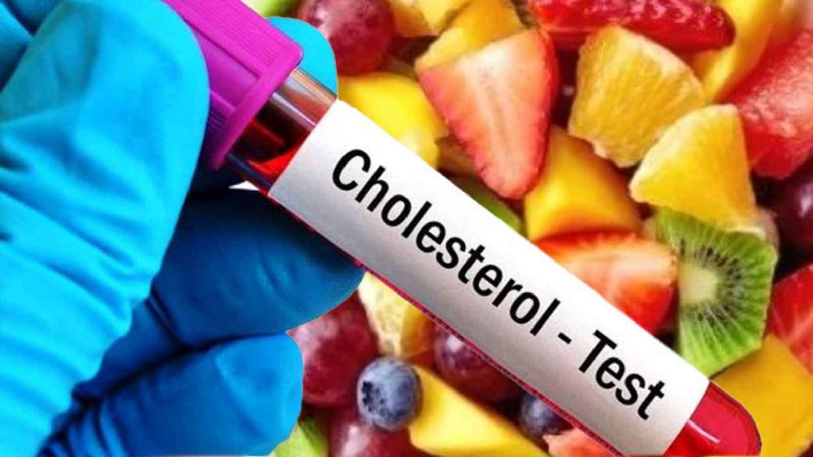 Cholesterol Diet: পাতে এই খাবার তাড়াবে কোলেস্টেরল - Bengali News 