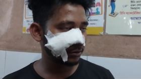 এক ঘুষিতে ফাটে নাক! তৃণমূল ছাত্র পরিষদের দুই নেতার দ্বন্দ্ব প্রকাশ্যে এক ঘুষিতে ফাটে নাক! তৃণমূল ছাত্র পরিষদের দুই নেতার দ্বন্দ্ব প্রকাশ্যে