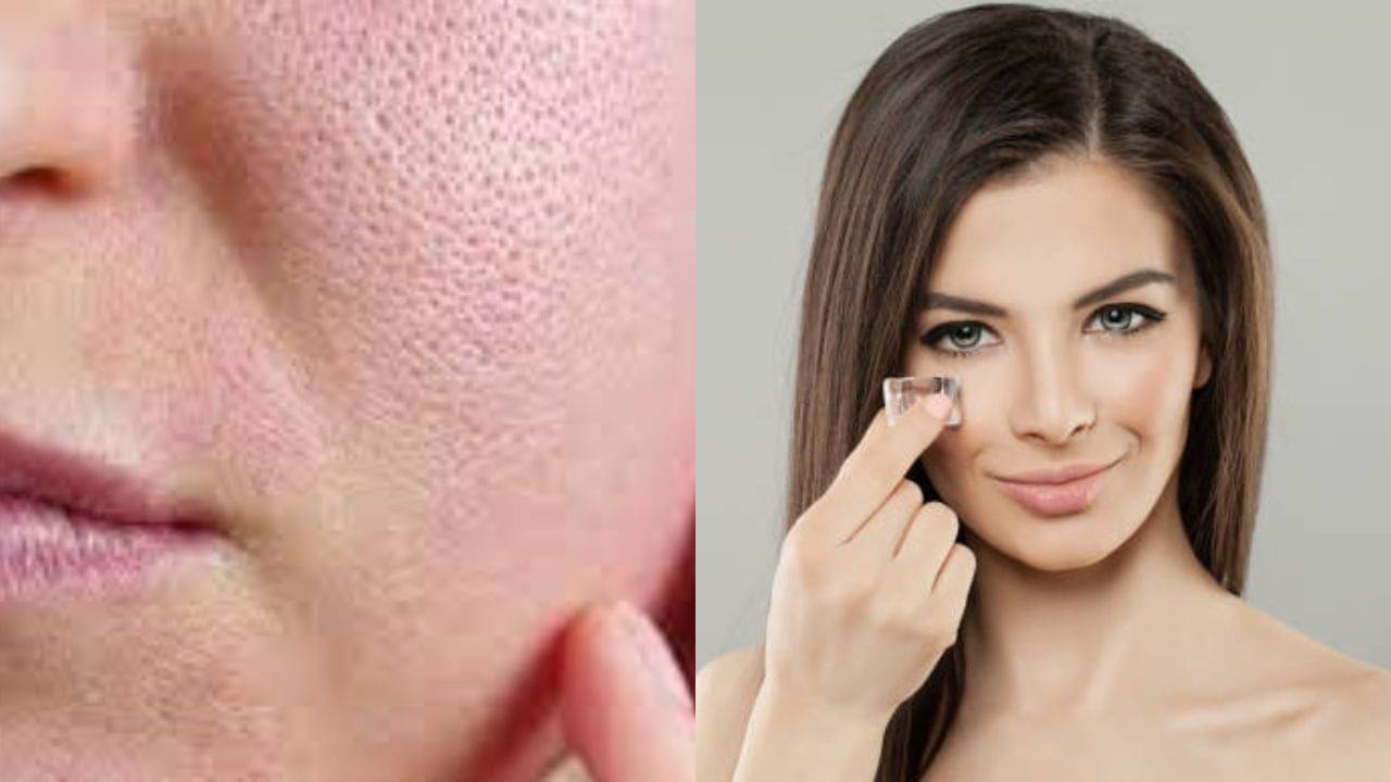 Open Pores: নাকের দুপাশে বাড়ছে ওপেন পোরস? ১৫ সেকেন্ড বরফ ঘষলেই পাবেন মসৃণ ত্বক