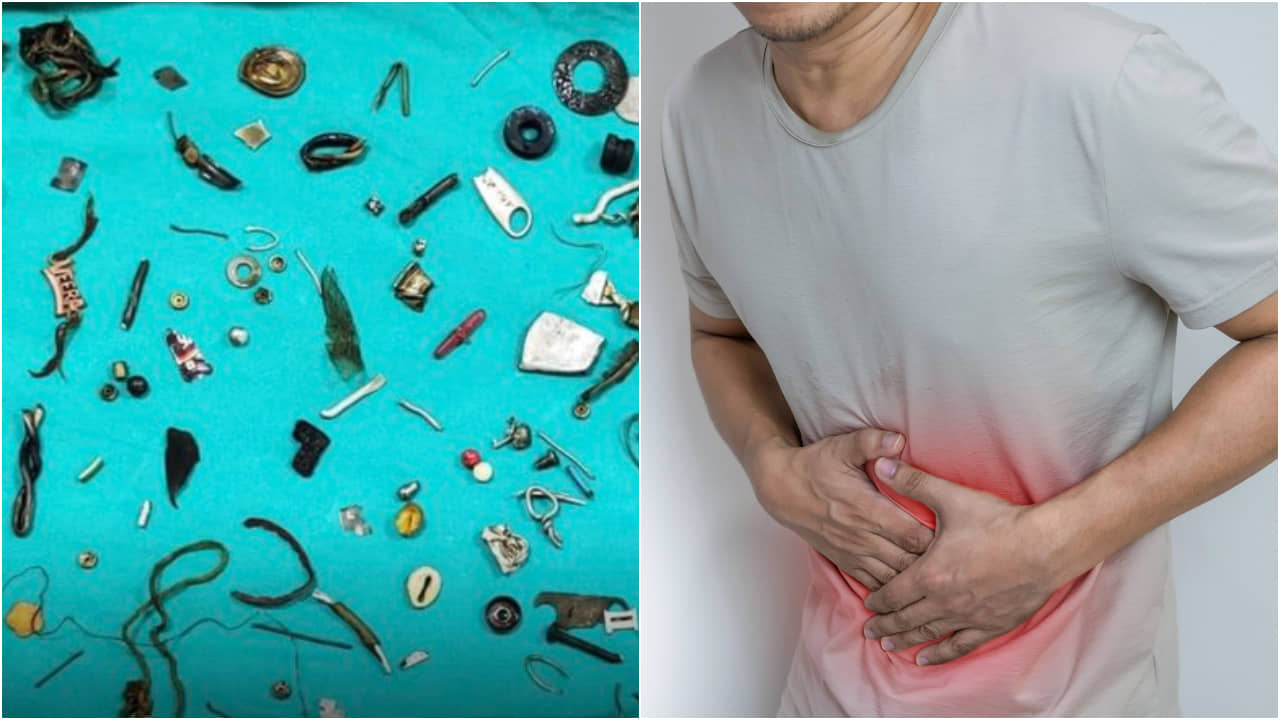 Punjab: ইয়ারফোন, লকেট, স্ক্রু, রাখি - পেট তো নয় যেন জাদুঘর! হতবাক ডাক্তাররা