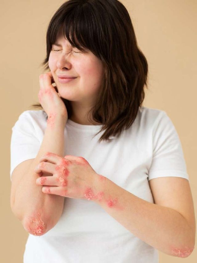 allergy-testing-for-mold-allergy-remedies-dust-mite-allergy