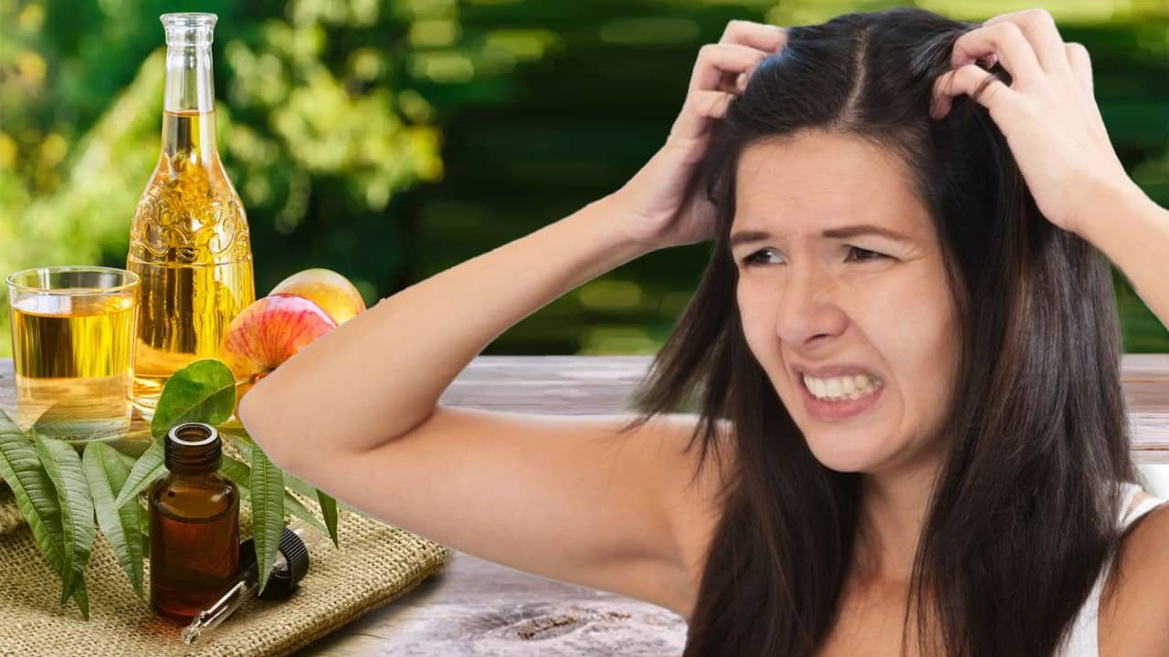 Dandruff: খুশকির সমস্যায় টেকা দায়? ভরসা রাখুন প্রাকৃতিক উপায়ে