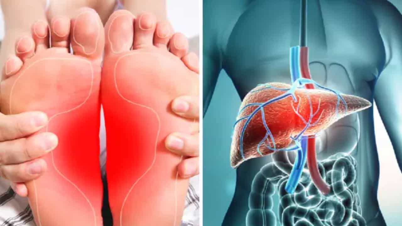 Fatty Liver: ফ্যাটি লিভারের সমস্যা জানান দেবে পায়ের মাধ্যমে, কীভাবে তাই ভাবছেন তো? জানুন Fatty Liver: ফ্যাটি লিভারের সমস্যা জানান দেবে পায়ের মাধ্যমে, কীভাবে তাই ভাবছেন তো? জানুন