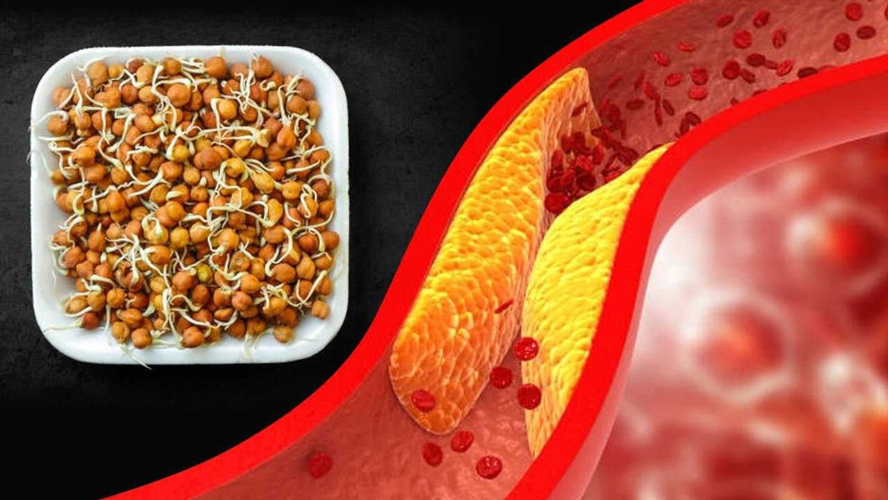 Sprouted Gram Benefits: রোজ সকালে একবাটি ছোলা খেলেই সুগার, কোলেস্টেরল থাকবে নিয়ন্ত্রণে, একফোঁটাও ওজন বাড়বে না