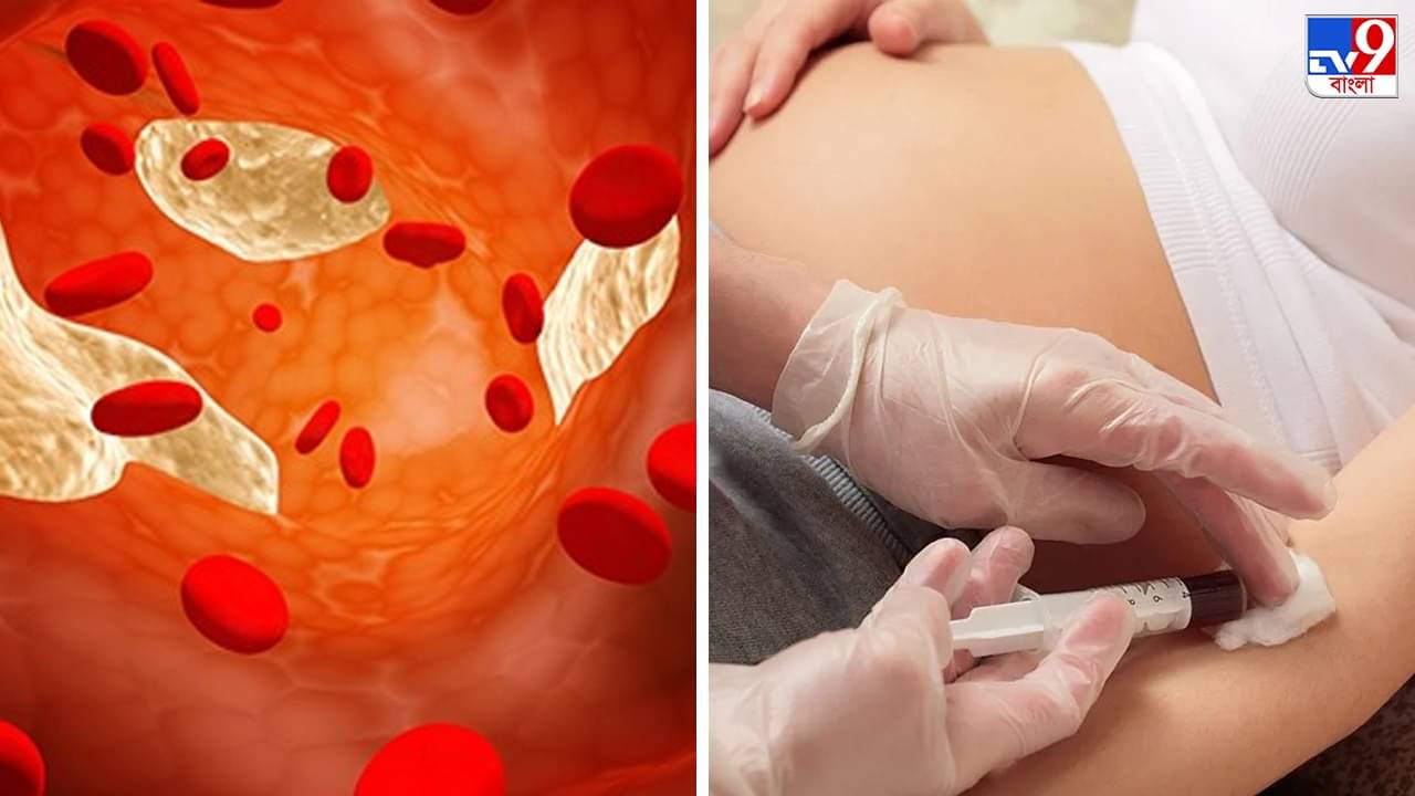 Cholesterol: গর্ভাবস্থায় বাড়ছে কোলেস্টেরলের ঝুঁকি, প্রতিকার কী? বিপদ হওয়ার আগে জানুন