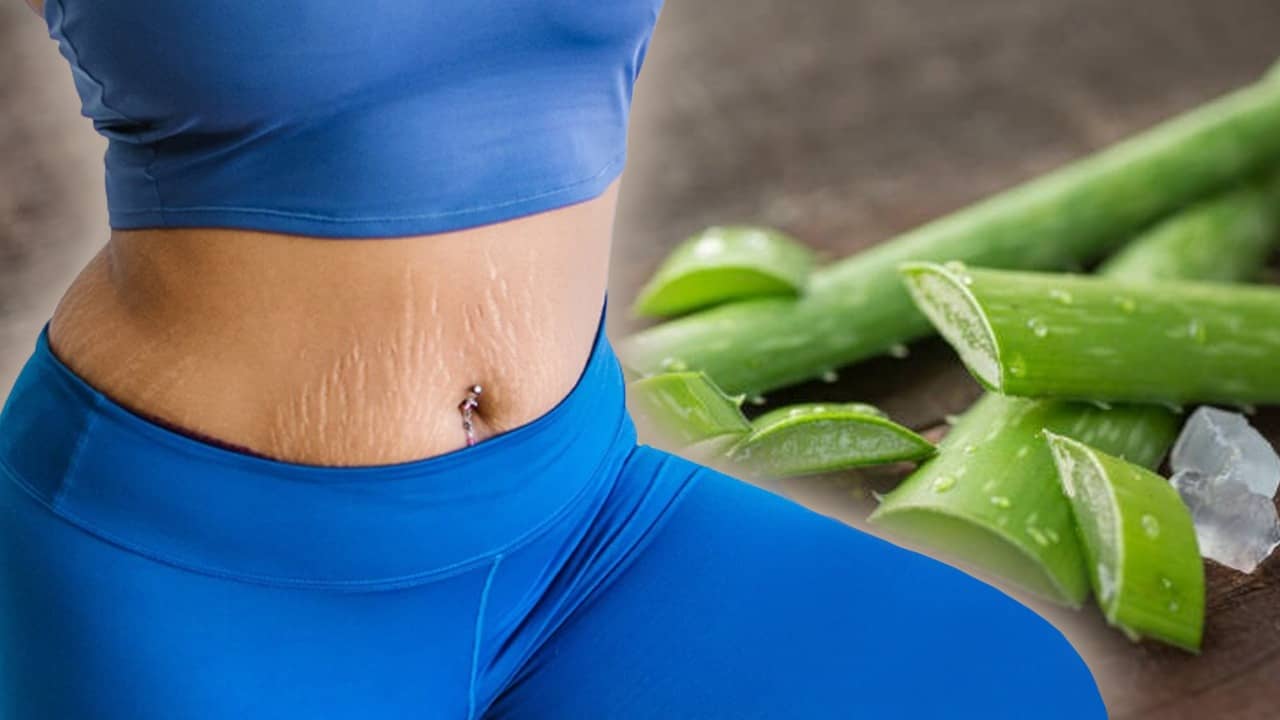 Stretch Marks: পুজোয় ক্রপ টপ পরার ইচ্ছে রয়েছে? এভাবে অ্যালোভেরা জেল মেখে উধাও করুন স্ট্রেচ মার্কস