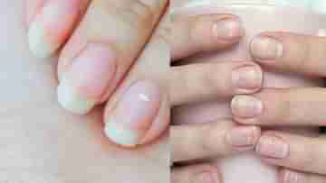 White Spots On Nails: নখের উপরে সাদা দাগ? দেখেও এড়িয়ে গেলেই বিপদ, সতর্ক হন