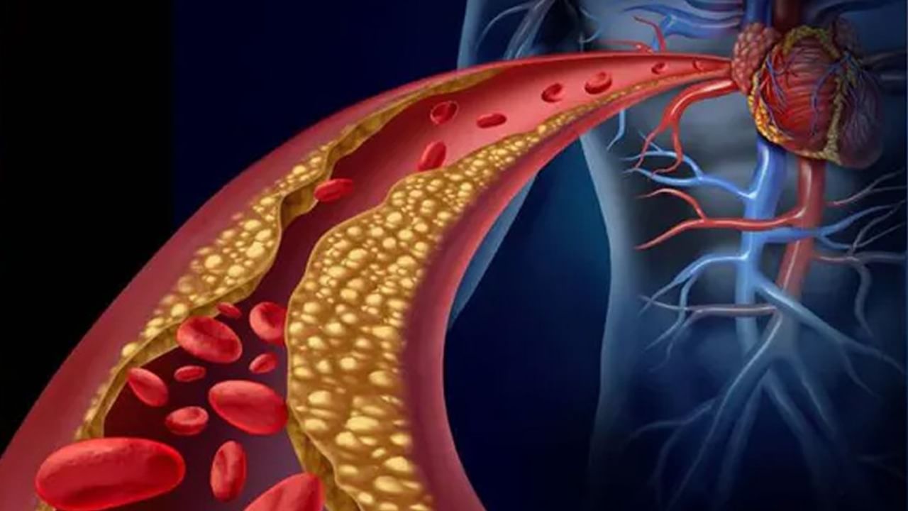 Cholesterol Control: ওষুধ ও জীবনযাপন কমাবে কোলেস্টেরল