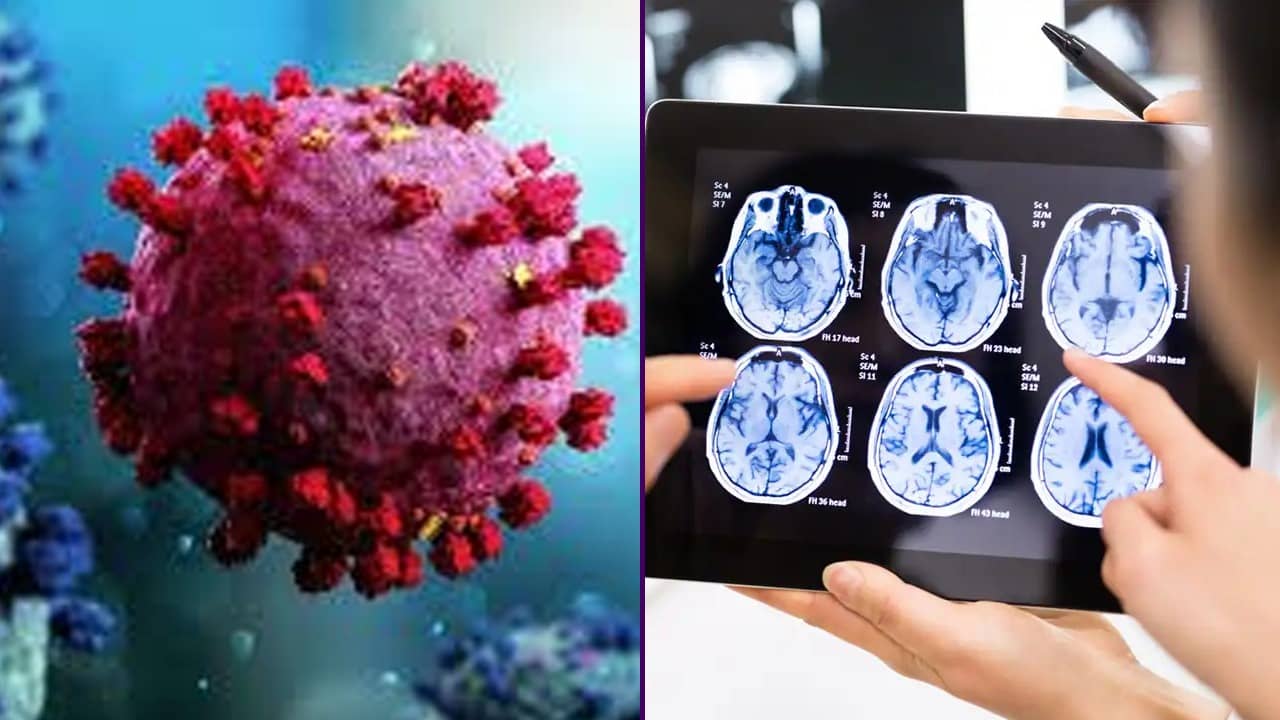 Covid-19: কোভিড থেকে সেরে ওঠার পরেও প্রাণঘাতী মস্তিষ্কের অসুখে আক্রান্ত হতে পারেন