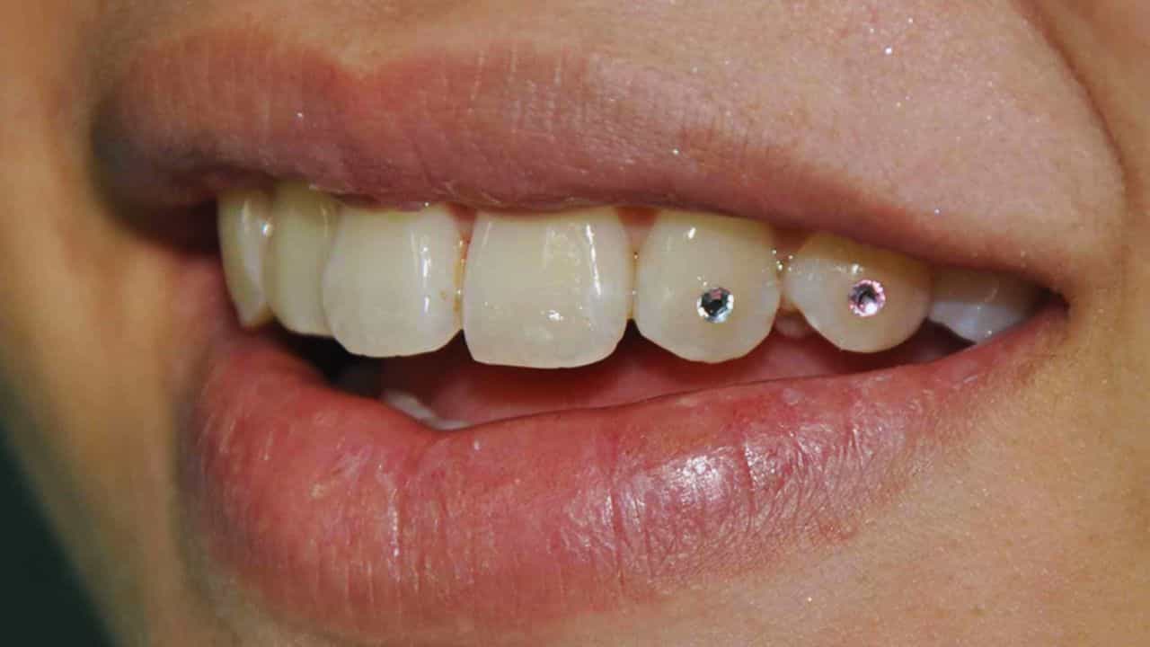 Diamond in Teeth: পুজোয় ৩২ পাটি দাঁতে হিরে বসালেন যুবতী, খরচ কত জানেন? Diamond in Teeth: পুজোয় ৩২ পাটি দাঁতে হিরে বসালেন যুবতী, খরচ কত জানেন?