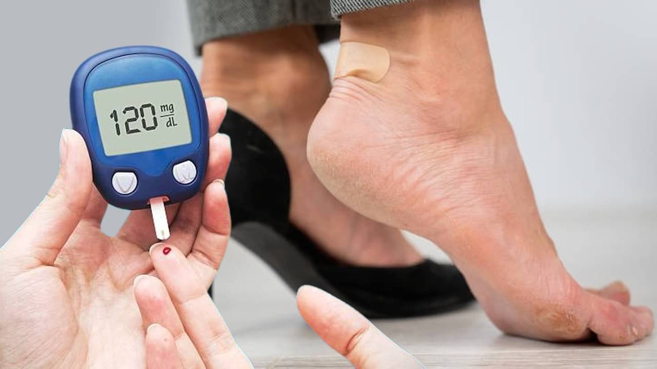Diabetes and Skin:  কালো দাগ ভেবে উপেক্ষা নয়, রক্তে চিনির মাত্রার অত্যধিক বাড়াবাড়ির কারণেই এমন হাল ত্বকের