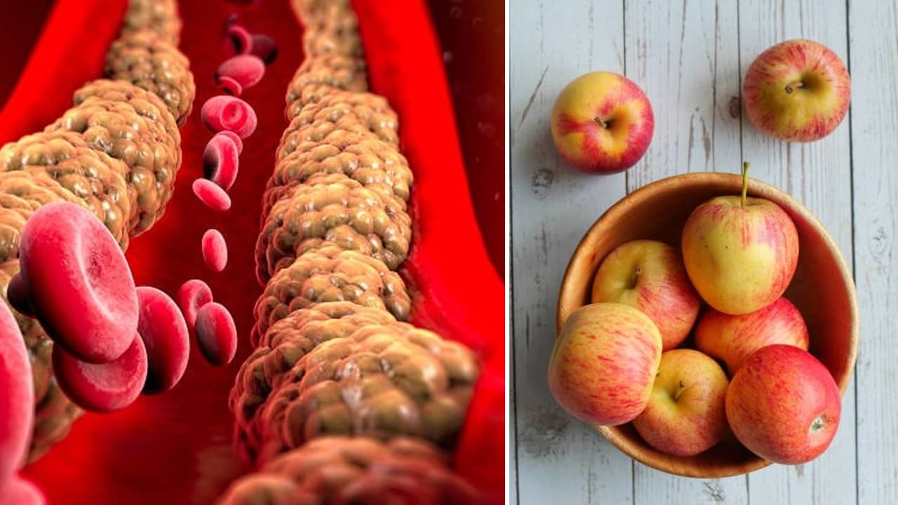 Apple For Cholesterol: আপেলের প্রতি কামড়েই গলবে কোলেস্টেরল, তবে সময় মেনে খেতে হবে