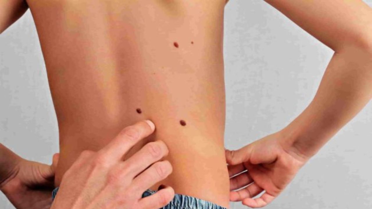 সামুদ্রিক শাস্ত্র অনুসারে, যদি কোনও ব্যক্তির কাঁধের নীচে তিল থাকে, তাহলে সামুদ্রিক শাস্ত্র অনুসারে তা অশুভ। এমন ব্যক্তিকে জীবনে অনেক সংগ্রাম করতে হয়। ছোটখাটো সাফল্য পেতেও অনেক সংগ্রাম করতে হয়। পিঠে তিল থাকলে কিছুটা অলসও হতে পারেন। 