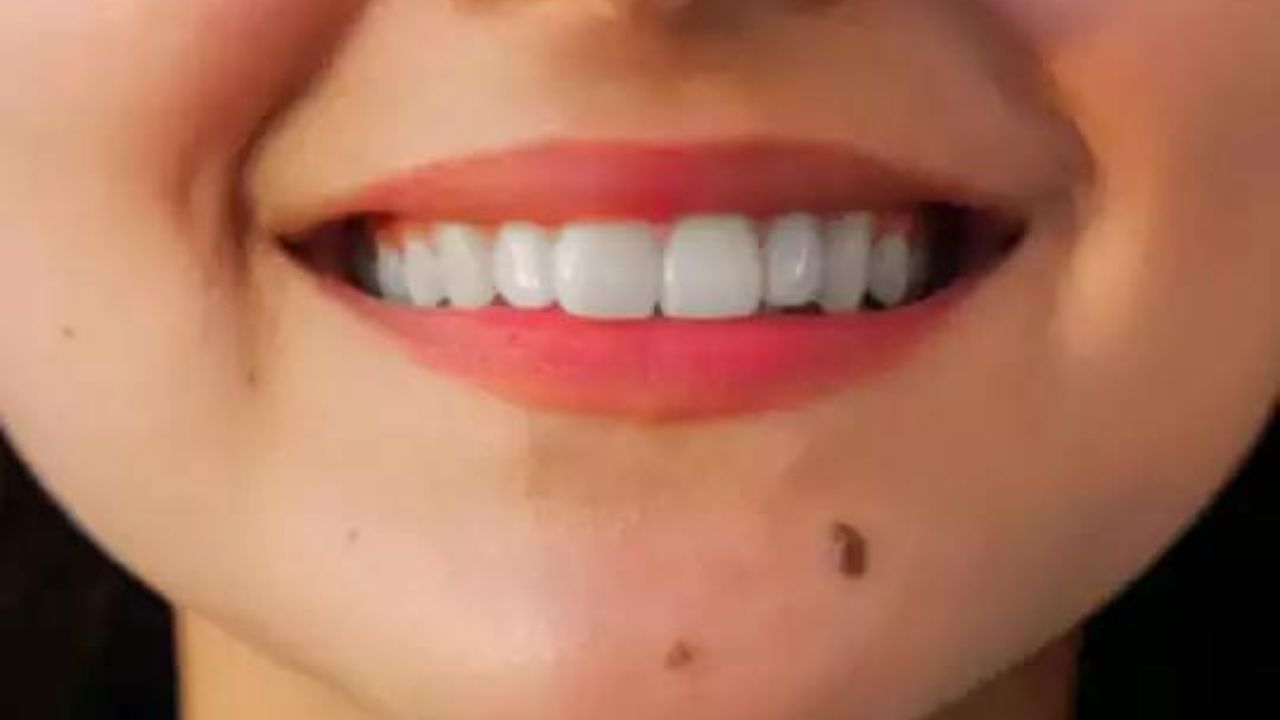 যদি কোনও ব্যক্তির ঠোঁটে তিল থাকে তবে তাকে তার স্বাস্থ্যের প্রতি যত্নবান হতে হবে। সমুদ্র শাস্ত্র অনুসারে, এই ধরনের ব্য়ক্তিদের স্থূলতা এবং স্বাস্থ্য সমস্যার সম্মুখীন হতে হয়। ঠোঁটে তিলের উপস্থিতি ওই ব্যক্তিকে রোমান্টিক ও যৌন চাহিদার ইচ্ছা বেশি থাকে।