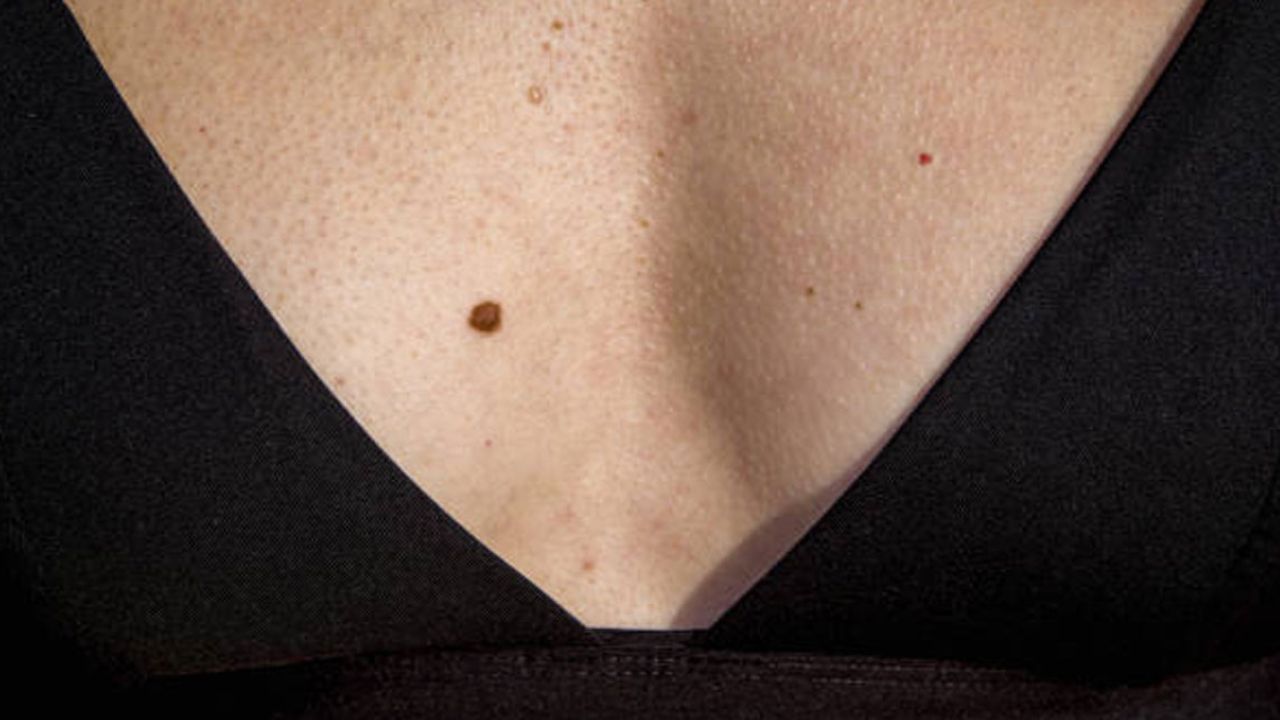 নারী ও পুরুষ, উভয়ের বুকেই তিল থাকে। লাল ও কালো তিলও থাকে। বুকে জান পাশে তিল থাকা অত্যন্ত শুভ। স্ত্রী হিসেবে ভাগ্যবান হন পুরুষরা। জ্যোতিষশাস্ত্র অনুসারে, বুকের ডানপাশে তিল থাকলে অর্থ আসে হু হু করে। এছাড়া বুকের মাঝে বা ক্লিভেজেও তিল থাকে। জ্যোতিষশাস্ত্রমতে, তাতে ব্য়ক্তি বা নারীরা সাহসী হন। ভাল পিতা-মাতা হিসেবেও গণ্য হন তারা। 