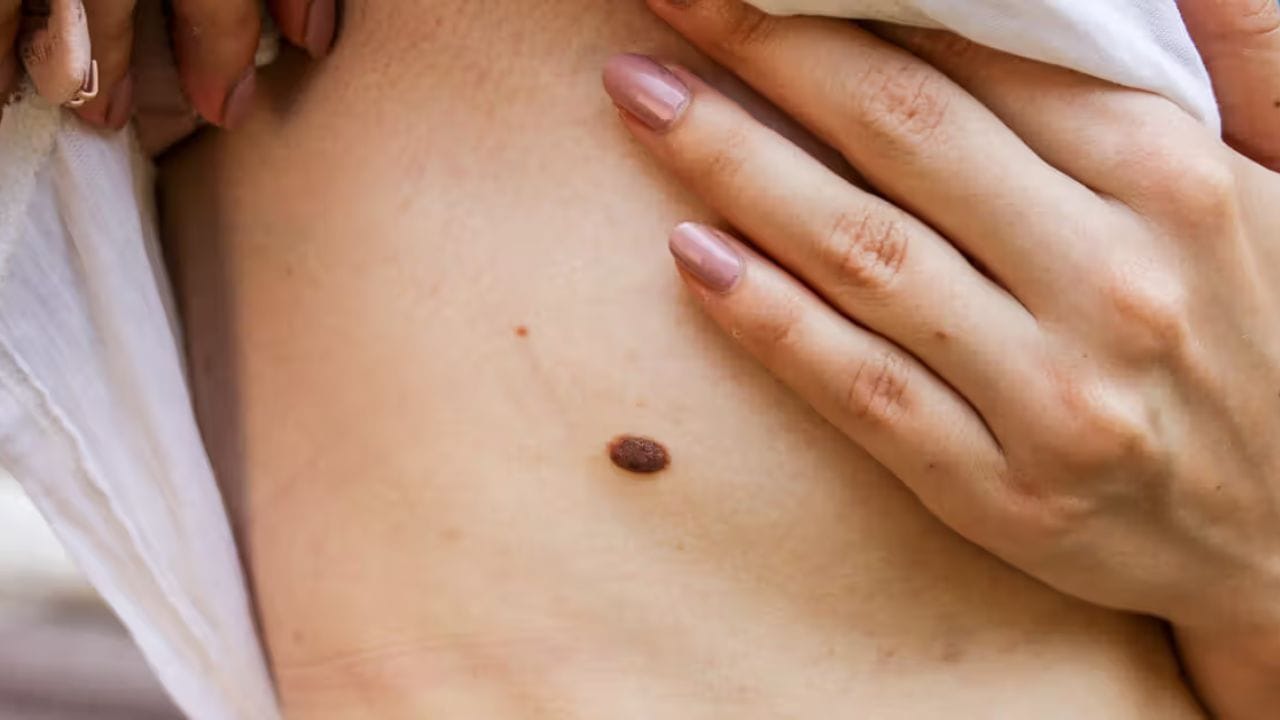 বুকের বাম পাশে তিল থাকলে তাও শুভ।এদের স্বভাব অত্যন্ত চঞ্চল হয়ে থাকে। অধিক বয়সে বিয়ে হওয়ার সম্ভাবনা থাকে। এছাড়া বাম দিকে তিল থাকলে কর্মক্ষেত্রে সাফল্য ও উন্নতির সম্ভাবনা থাকে। তবে ছোট ছোট বিষয় নিয়ে মাথা গরম করার প্রবণতা তৈরি হয় তাদের। 